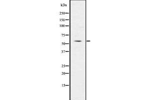 Western blot analysis of IRG1 using LOVO whole  lysates. (IRG1 Antikörper  (C-Term))