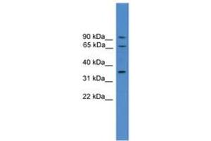 Calicin Antikörper  (AA 151-200)