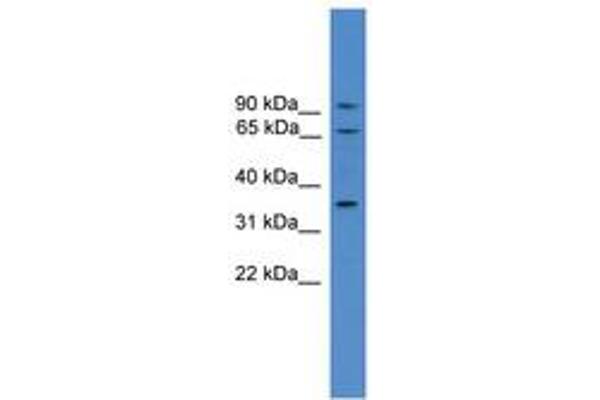 Calicin Antikörper  (AA 151-200)