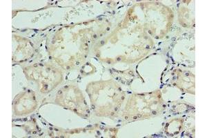 Immunohistochemistry of paraffin-embedded human kidney tissue using ABIN7144972 at dilution of 1:100 (DHX9 Antikörper  (AA 325-840))