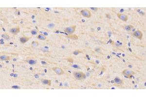Detection of MAP2 in Human Cerebrum Tissue using Polyclonal Antibody to Microtubule Associated Protein 2 (MAP2) (MAP2 Antikörper  (AA 727-985))