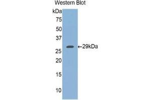 Western blot analysis of the recombinant protein. (FKBP8 Antikörper  (AA 93-339))