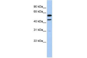 WB Suggested Anti-CCNB1 Antibody Titration:  0. (Cyclin B1 Antikörper  (C-Term))