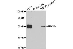 Immunoprecipitation analysis of 200 μg extracts of 293T cells using 1 μg RBBP4 antibody (ABIN5970697). (Retinoblastoma Binding Protein 4 Antikörper)