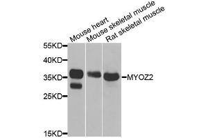Western blot analysis of extracts of various cell lines, using MYOZ2 antibody. (MYOZ2 Antikörper)