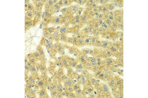 Immunohistochemistry of paraffin-embedded rat liver using ADCK3 antibody at dilution of 1:100 (x40 lens). (COQ8A Antikörper)