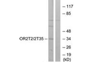 Western blot analysis of extracts from HepG2 cells, using OR2T2/2T35 Antibody.
