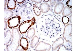 Immunohistochemistry (IHC) image for anti-Phospholipase D2 (PLD2) (AA 834-933) antibody (ABIN5542411)