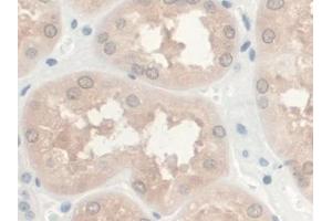 Detection of GREM1 in Human Kidney Tissue using Monoclonal Antibody to Gremlin 1 (GREM1) (GREM1 Antikörper  (AA 26-184))