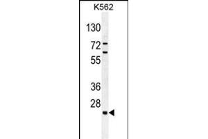 C15orf41 Antibody (Center) (ABIN654657 and ABIN2844354) western blot analysis in K562 cell line lysates (35 μg/lane). (BC052040 Antikörper  (AA 167-193))