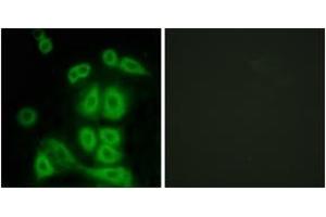 Immunofluorescence analysis of A549 cells, using FXR2 Antibody. (FXR2 Antikörper  (AA 551-600))