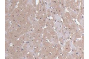 DAB staining on IHC-P; Samples: Rat Heart Tissue (Ninein Antikörper  (AA 1-153))
