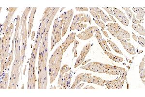 Immunohistochemistry (IHC) image for anti-R-Spondin 1 (RSPO1) (AA 21-135) antibody (ABIN7430144)