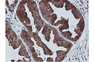Immunohistochemical staining of paraffin-embedded Human breast tissue using anti-C20orf3 mouse monoclonal antibody.