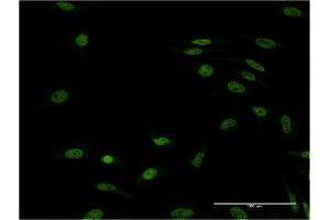 Immunofluorescence of monoclonal antibody to FOXL1 on HeLa cell. (FOXL1 Antikörper  (AA 132-240))