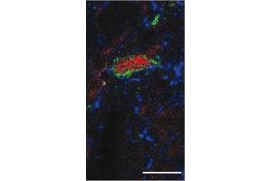 Immunofluorescence image of Substance P staining in vibratome section of rat spinal cord. (Substance P Antikörper)