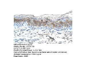 Rabbit Anti-FGA Antibody  Paraffin Embedded Tissue: Human Skin Cellular Data: Squamous epithelial cells Antibody Concentration: 4.