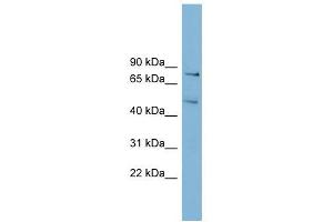 BOP1 antibody used at 1 ug/ml to detect target protein. (BOP1 Antikörper  (N-Term))