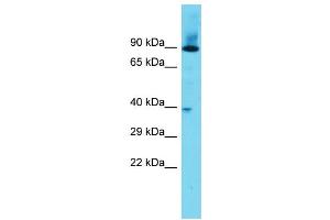 Host: Rabbit Target Name: DPY19L3 Sample Type: Fetal Heart lysates Antibody Dilution: 1. (DPY19L3 Antikörper  (N-Term))