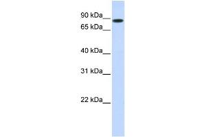 WB Suggested Anti-STAT5B Antibody Titration: 1 ug/ml Positive Control: 293T cells lysate There is BioGPS gene expression data showing that STAT5B is expressed in HEK293T (STAT5B Antikörper  (N-Term))