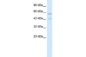 Western Blotting (WB) image for anti-Cholinergic Receptor, Nicotinic, alpha 5 (Neuronal) (CHRNA5) (Middle Region) antibody (ABIN2776103)