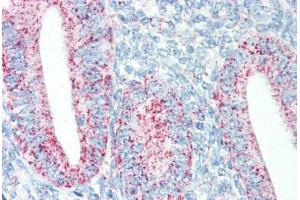 Human Uterus (formalin-fixed, paraffin-embedded) stained with HSPD1 antibody ABIN334251 at 5 ug/ml followed by biotinylated anti-mouse IgG secondary antibody ABIN481714, alkaline phosphatase-streptavidin and chromogen. (HSPD1 Antikörper)