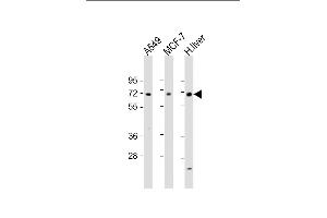 All lanes : Anti-HABP2 Antibody (C-term) at 1:1000-1:2000 dilution Lane 1: A549 whole cell lysate Lane 2: MCF-7 whole cell lysate Lane 3: human liver lysate Lysates/proteins at 20 μg per lane.