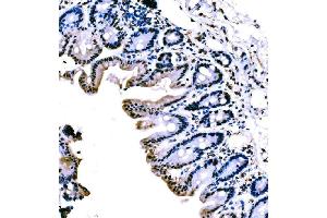 IHC analysis of KLF4 using anti-KLF4 antibody (ABIN7599343). (KLF4 Antikörper  (AA 1-389))