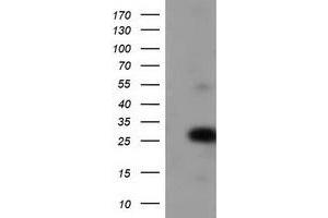 Western Blotting (WB) image for anti-Zinc Finger, AN1-Type Domain 2B (ZFAND2B) antibody (ABIN1501809) (ZFAND2B Antikörper)