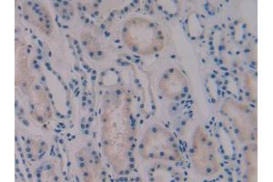 DAB staining on IHC-P; Samples: Human Kidney Tissue (Vip Antikörper  (AA 29-165))