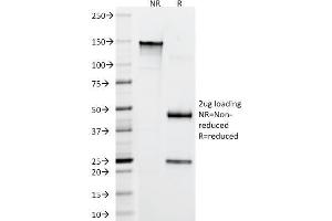 SDS-PAGE Analysis Purified CD22 Mouse Monoclonal Antibody (FR10B4). (CD22 Antikörper)