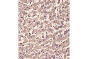 (ABIN652227 and ABIN2840949) staining TTR in human liver tissue sections by Immunohistochemistry (IHC-P - paraformaldehyde-fixed, paraffin-embedded sections). (TTR Antikörper  (C-Term))