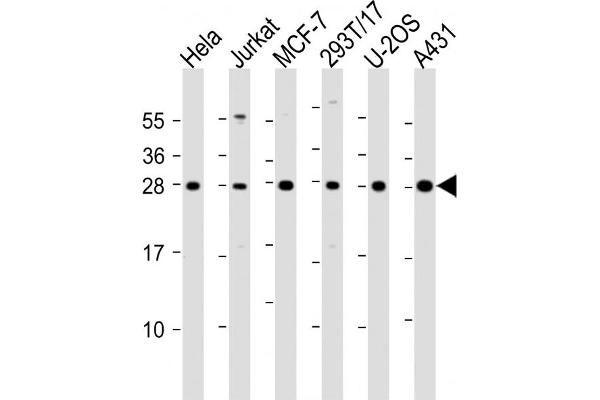 RPL14 anticorps  (AA 117-147)