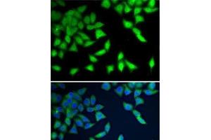Immunofluorescence analysis of A-549 cells using WDR77 Polyclonal Antibody (WDR77 Antikörper)