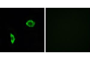Immunofluorescence analysis of LOVO cells, using Prostacyclin Receptor antibody. (Prostacyclin Receptor Antikörper)