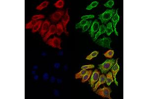 ABIN6261858 and ABIN6276889 staining Hela cells by IF/ICC.