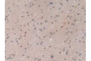 IHC-P analysis of Human Brain Tissue, with DAB staining. (HSP70 1A Antikörper  (AA 285-641))