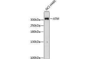 Western blot analysis of extracts of H460 cells, using ATM Antibody (ABIN6133566, ABIN6137281, ABIN6137282 and ABIN6221615) at 1:1000 dilution.