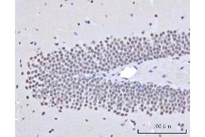 IHC analysis of RBM22 using anti-RBM22 antibody (ABIN7600268). (RBM22 Antikörper  (AA 17-406))