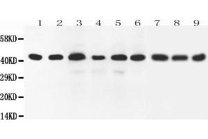 Western Blotting (WB) image for anti-SRY (Sex Determining Region Y)-Box 7 (SOX7) (AA 370-388), (C-Term) antibody (ABIN3042550) (SOX7 Antikörper  (C-Term))