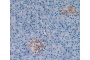 Detection of SP in Human Pancreas Tissue using Polyclonal Antibody to Substance P (SP) (Substance P Antikörper)