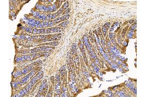 ABIN7094744 and ABIN7098795 at 1/100 staining Rat colorectal tissue by IHC-P. (UGT1A6 Antikörper  (N-Term))