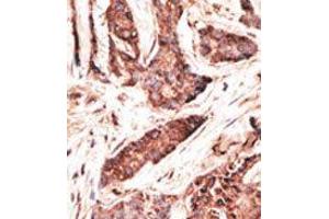 Image no. 2 for anti-2'-5'-Oligoadenylate Synthetase-Like (OASL) (C-Term) antibody (ABIN358720) (OASL Antikörper  (C-Term))