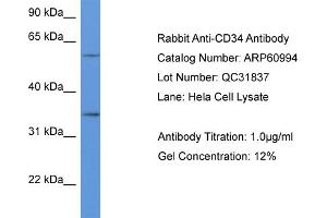 Western Blotting (WB) image for anti-CD34 (CD34) (C-Term) antibody (ABIN2788647) (CD34 Antikörper  (C-Term))