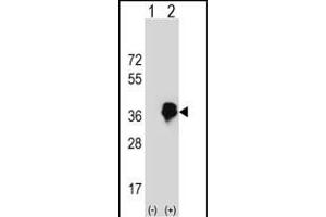 Western blot analysis of MLX (arrow) using rabbit polyclonal MLX Antibody (Center) (ABIN652578 and ABIN2842390). (MLX Antikörper  (AA 125-151))