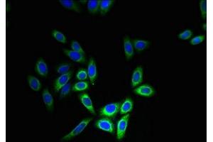 Immunofluorescence (IF) image for anti-Cytochrome B5 Type B (Outer Mitochondrial Membrane) (CYB5B) (AA 2-118) antibody (ABIN7149122)