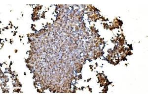 IHC analysis of LSM2 using anti-LSM2 antibody (ABIN7602832).