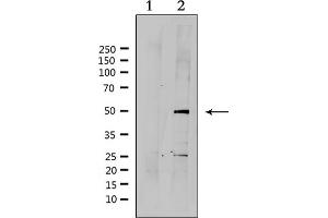 Western blot analysis of extracts from HepG2, using SUV39H2 Antibody. (SUV39H2 Antikörper  (Internal Region))