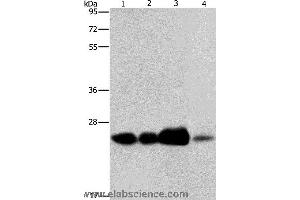Western blot analysis of 293T cell and human fetal liver tissue, human cervical cancer and fetal muscle tissue, using ARFRP1 Polyclonal Antibody at dilution of 1:800 (ARFRP1 Antikörper)