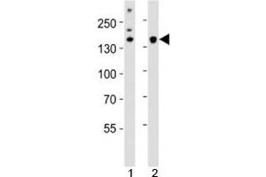 Western blot analysis of lysate from 1) HeLa cell line and 2) mouse cerebellum tissue using Kdm6b antibody at 1:1000. (Kdm6b Antikörper  (AA 1023-1057))